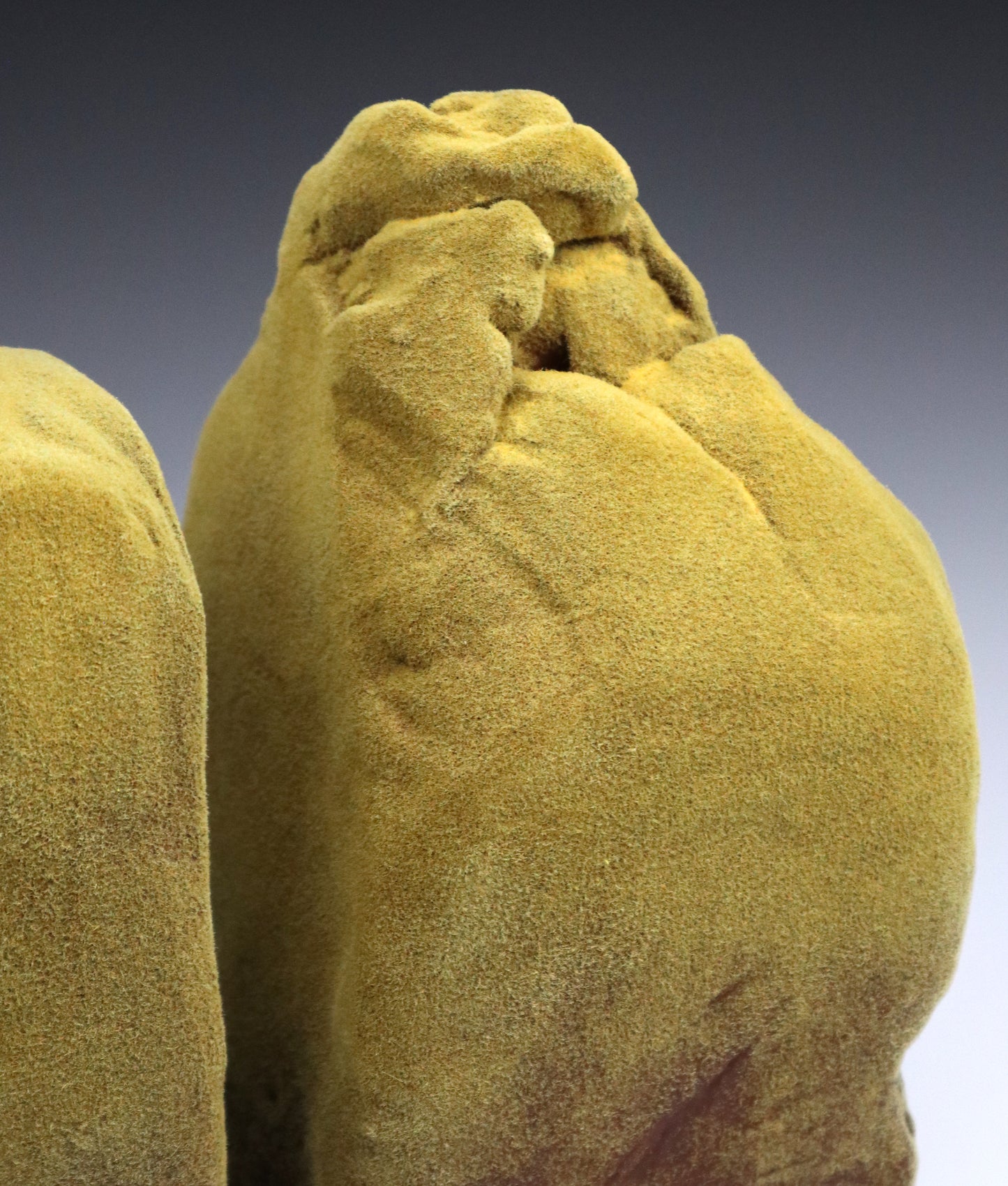 Abrasion 4